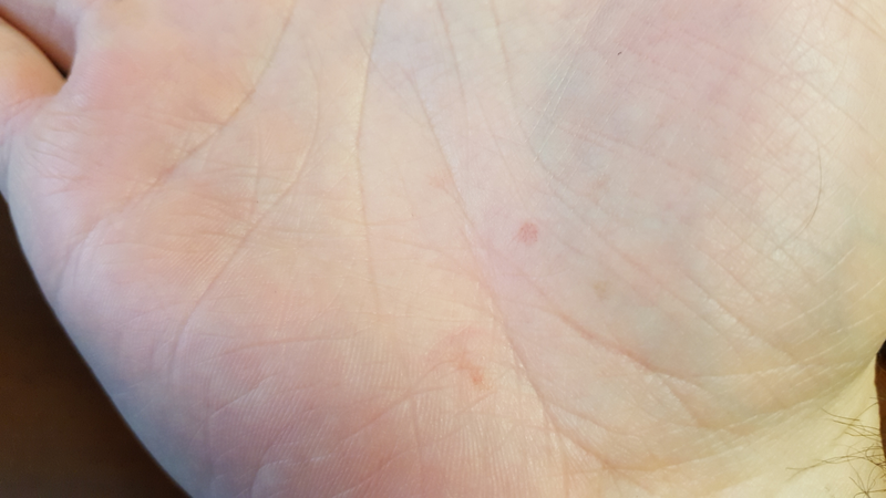 You have to suffer for your PCV valve.
